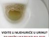 Vidite li mjehuriće u urinu? To može ukazivati na ozbiljnije zdravstveno stanje!