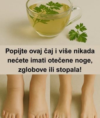 Ovaj čaj me spasio – pijte ovaj čaj i nikada više nećete imati otečene noge, gležnjeve ili stopala!