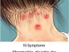 10 Symptome von Fibromyalgie, die jeder mit Muskelschmerzen lesen sollte