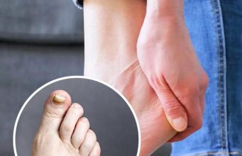 Ein Apotheker enthüllt zwei Warnzeichen für einen stillen Mörder, die Sie an Ihren Füßen erkennen könnten