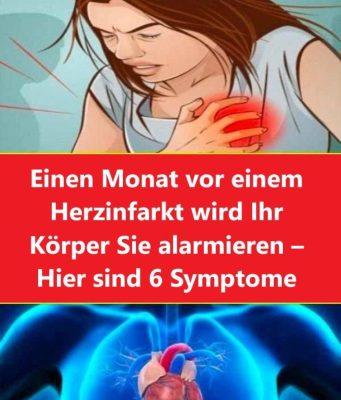 Unmittelbar vor einem Infarto – Du warst alarmiert – Es sind 6 Monate vergangen
