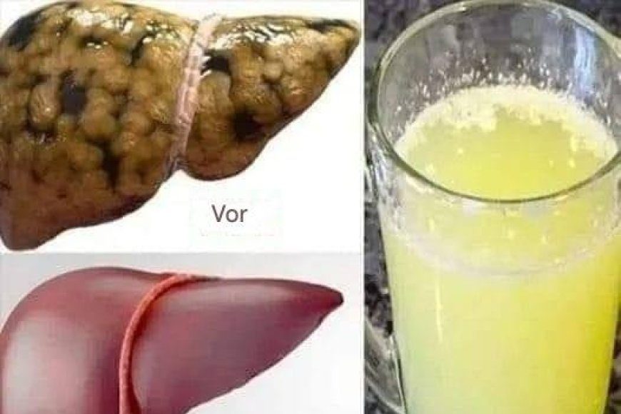 image_870x_6853261907172