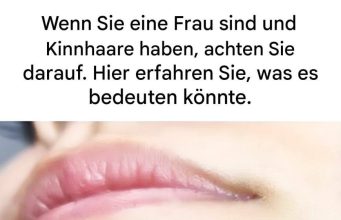 Kinnhaare bei Frauen: Was bedeutet das