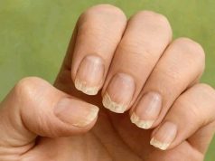 Splittern oder brechen Ihre Nägel ständig? Das ist es, was Ihr Körper Ihnen sagen möchte.