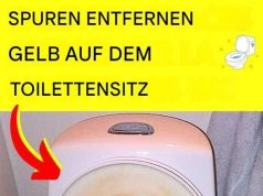 Der Trick, um gelbe Flecken auf dem WC-Sitz zu entfernen